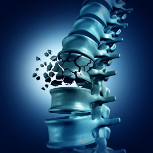 Spinal Fracture and traumatic vertebral injury 